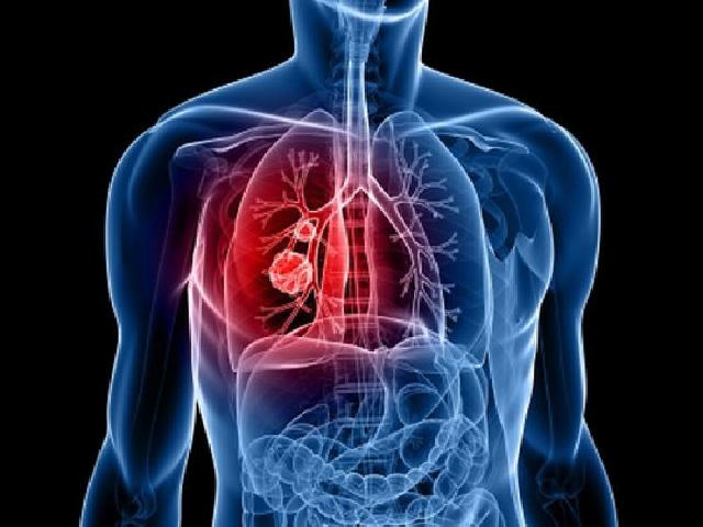 Begini Cara Buang Racun Tubuh yang Benar  