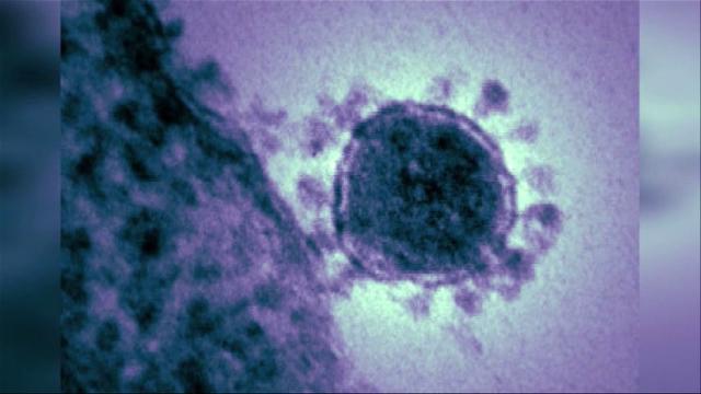 Aduh, Ada 3 Warga Pekanbaru Diduga Terjangkit Virus MERS