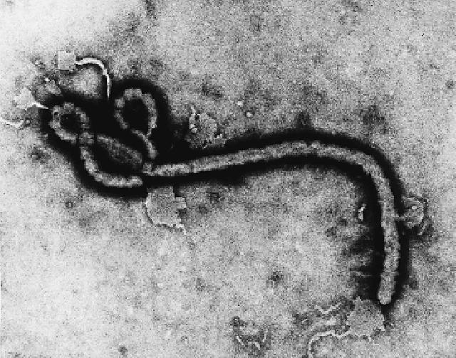 Dokter di New York Ini Positif Ebola  