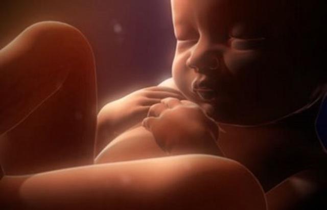 Bayi Ini Terlahir dengan Ekor, Dokter Tak Berani Potong
