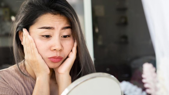 Mengenal Moon Face, Wajah yang Tiba-tiba Membulat Kayak Bulan: Ini Kata Ahli Kesehatan