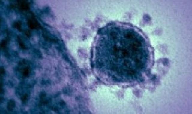 Arab Saudi Peringatkan Jamaah Haji Tentang Koronavirus