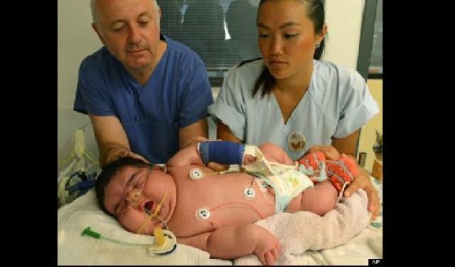 Wow, Bayi Berukuran Raksasa Lahir di Jerman