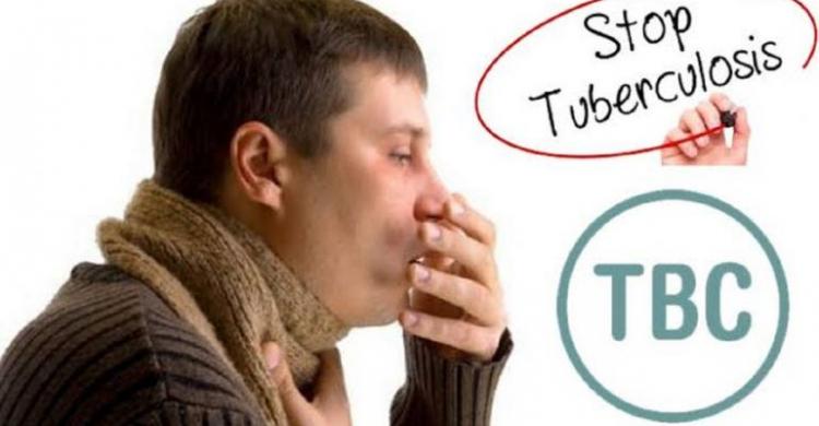 Indonesia Peringkat ke-3 TBC Tertinggi Dunia